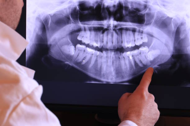 Best Knocked-Out Tooth Emergency  in Fairview Shores, FL
